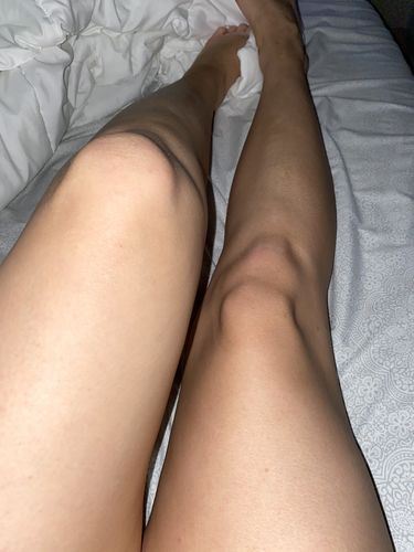 Customer photo review of Defective Bottle