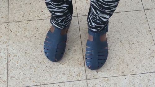 Customer photo review of Dr. CARE™ - PREMIUM ORTHOPEDIC ROUND TOE SANDALS