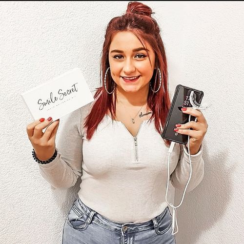 Customer photo review of PAP+ LED Teeth Whitening Kit