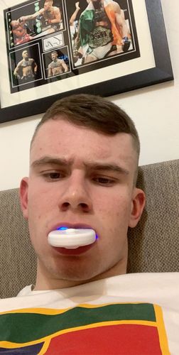 Customer photo review of Teeth Whitening Kit