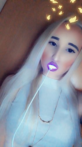 Customer photo review of SmileSecret Phonebleaching®