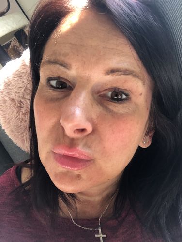 Customer photo review of LIP BOOSTING SYSTEM