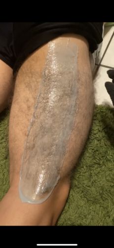 Customer photo review of Signature Series Hair Removal Wax