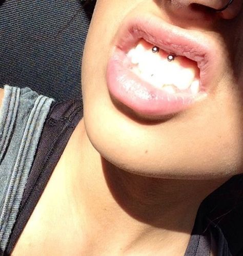 Customer photo review of DentaClean™ Ultrasonic Tooth Cleaner