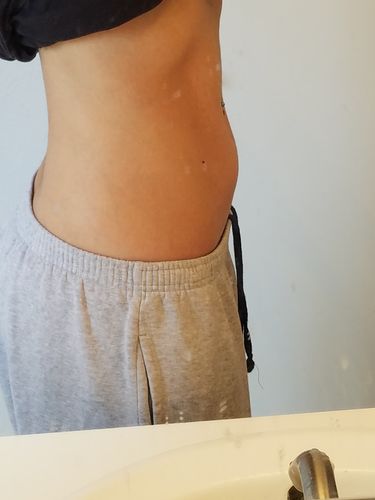 Customer photo review of 15 Uses Magnesium Therapy Herbal Wrap