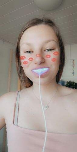 Customer photo review of PAP+ LED Teeth Whitening Kit