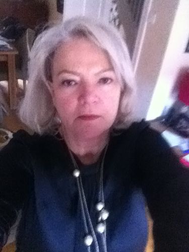 Customer photo review of Rosalique 3 in 1 Anti-Redness Miracle Formula SPF50