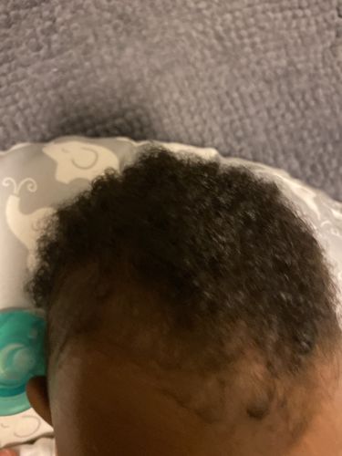 Customer photo review of Fro Butter with Emu Oil - Hair Growth Butter