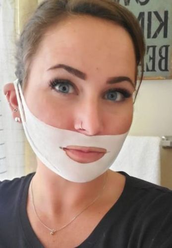 Customer photo review of DermaV™  |  Masque amincissant pour ovale du visage