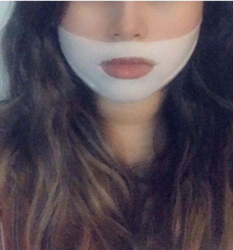 Customer photo review of DermaV™  |  Masque amincissant pour ovale du visage