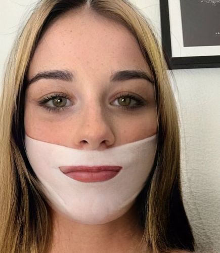 Customer photo review of DermaV™  |  Masque amincissant pour ovale du visage