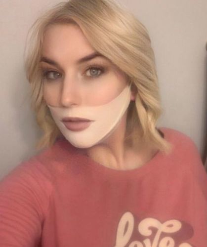 Customer photo review of DermaV™  |  Masque amincissant pour ovale du visage