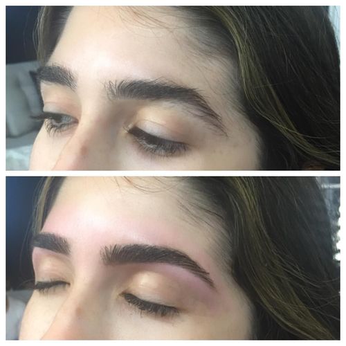 Customer photo review of On-Fleek Brows™ Eyebrow Epilator Pro