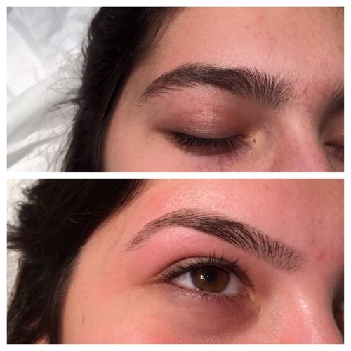 Customer photo review of On-Fleek Brows™ Eyebrow Epilator Pro