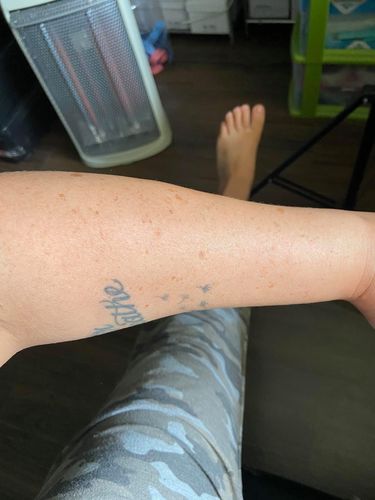 Customer photo review of Defective Bottle