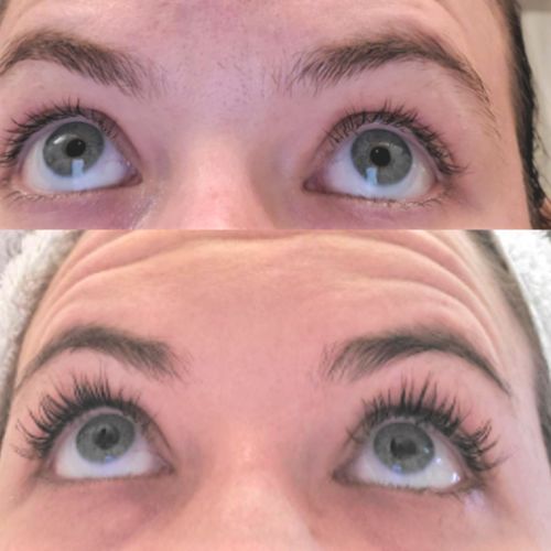 Customer photo review of SHOW LASH