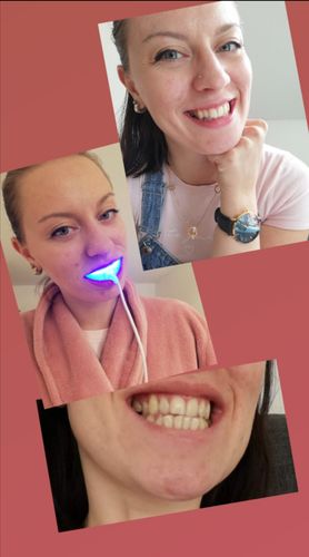 Customer photo review of SmileSecret Oster Special