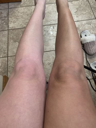 Customer photo review of Desert Bronze Self Tanning Mousse READY TO SHIP!!