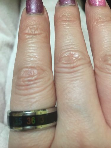 Customer photo review of Incoobo "Virus Temperature Measure Ring"® - 30% OFF TODAY ONLY