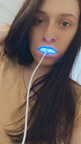 Customer photo review of SmileSecret Refill Pens Angebot