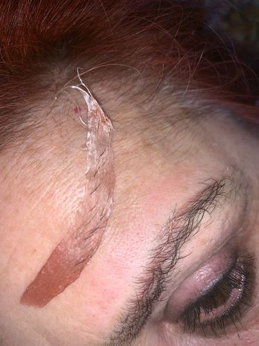 Customer photo review of KIT ÉPILATION 4X CIRES (+1 SPATULE GRATUITE)