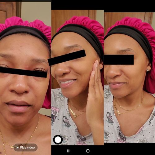 Customer photo review of SkinCare Bundle