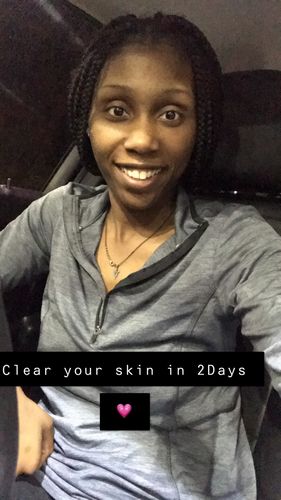 Customer photo review of Turmeric 6 Pack