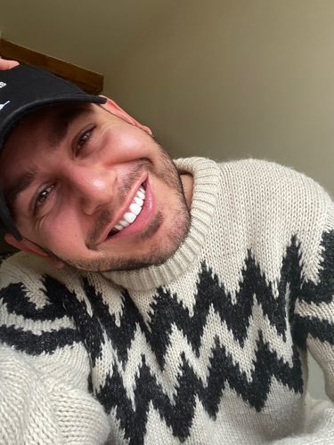 Customer photo review of Teeth Whitening Kit