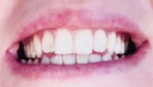 Customer photo review of Black Edition – Charcoal Tooth Polish