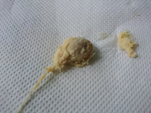 Customer photo review of Perle de Detox Vaginale (Lot de 3 perles par sachet)