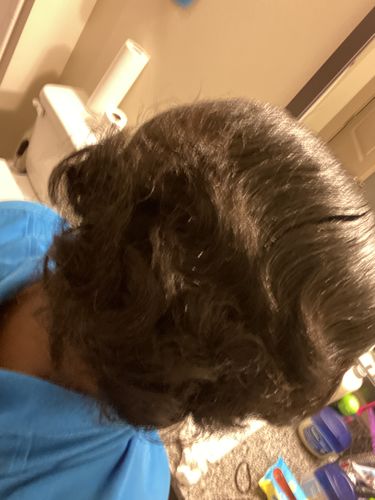 Customer photo review of PureFix Hair Elixir