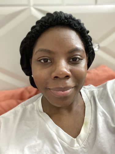 Customer photo review of SkinCare Bundle