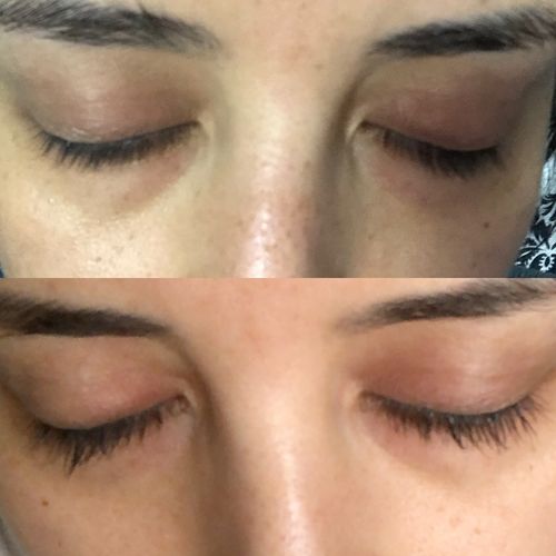 Customer photo review of Lash & Brow Bundle Kit