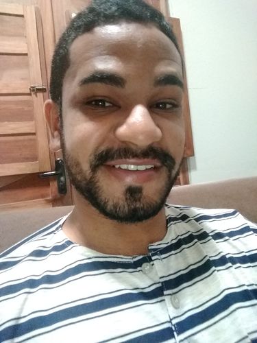 Customer photo review of Minoxidil 5% Kirkland - 3 Meses de Tratamento Contra Queda de Cabelo, Barba e Sobrancelha.