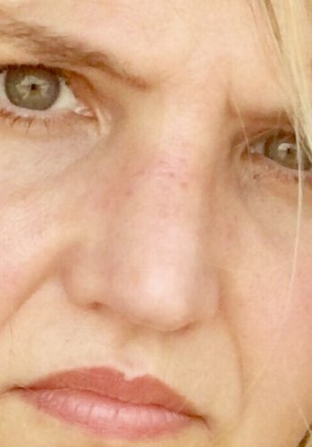 Customer photo review of WONDER BLADING Peel & Reveal Lip Color Kit