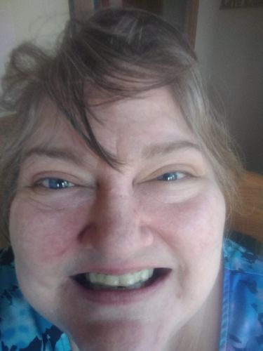 Customer photo review of Night Guard