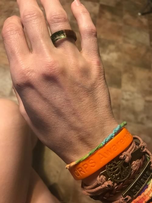 Customer photo review of Forest Soul Resin Ring