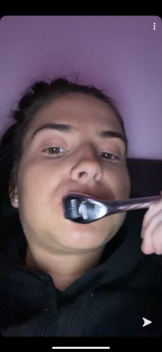 Customer photo review of LIP BOOSTING SYSTEM