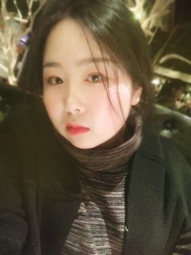 Customer photo review of Forest Paris Dream (12 Month) Contact Lenses