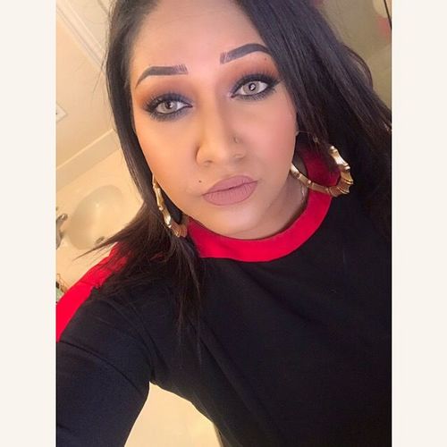 Customer photo review of Forest Paris Dream (12 Month) Contact Lenses
