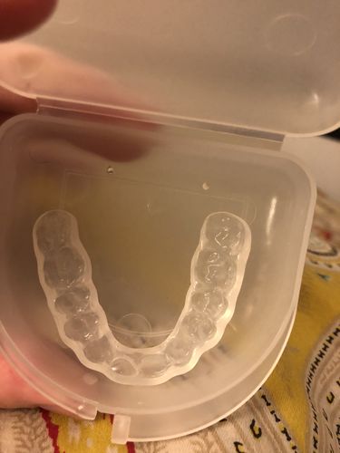 Customer photo review of Night Guard