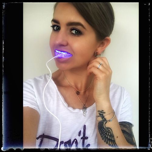 Customer photo review of PAP+ LED Teeth Whitening Kit