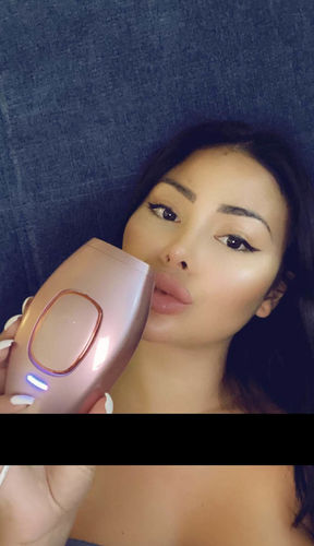 Customer photo review of Badieskin®️ pro 2