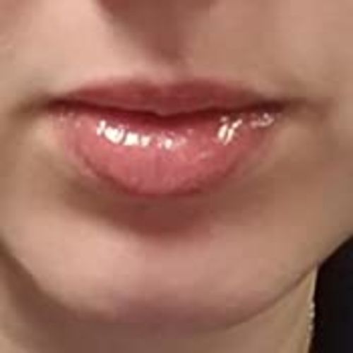 Customer photo review of LANBENA LIPS CARE SERUM