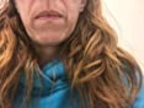 Customer photo review of LANBENA LIPS CARE SERUM