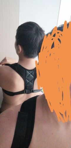 Customer photo review of Corrector de postura Fixeregy™