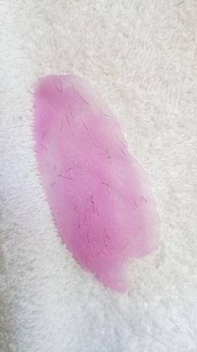 Customer photo review of At-Home Signature Series Hair Removal Wax