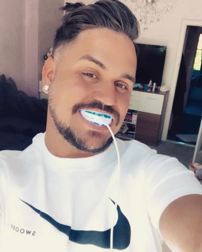 Customer photo review of PAP+ LED Teeth Whitening Kit
