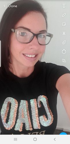 Customer photo review of Teeth Whitening Kit