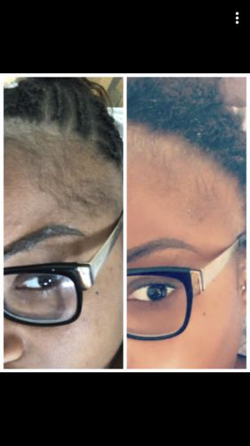 Customer photo review of Good Hair Vitamins - 1 mois